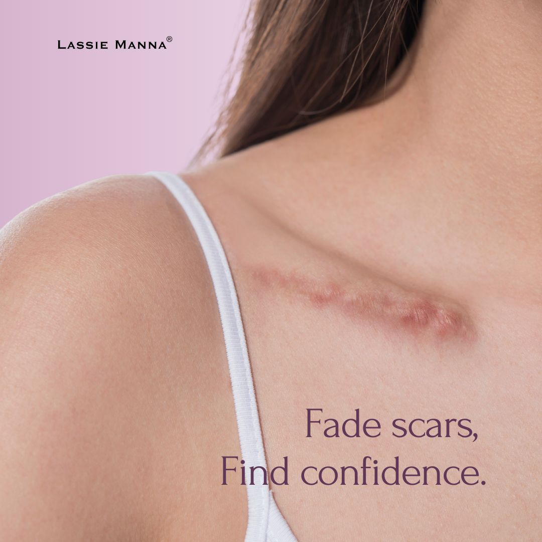 Pure Harmony Silky Oil Synergy Blend (Scar EO)